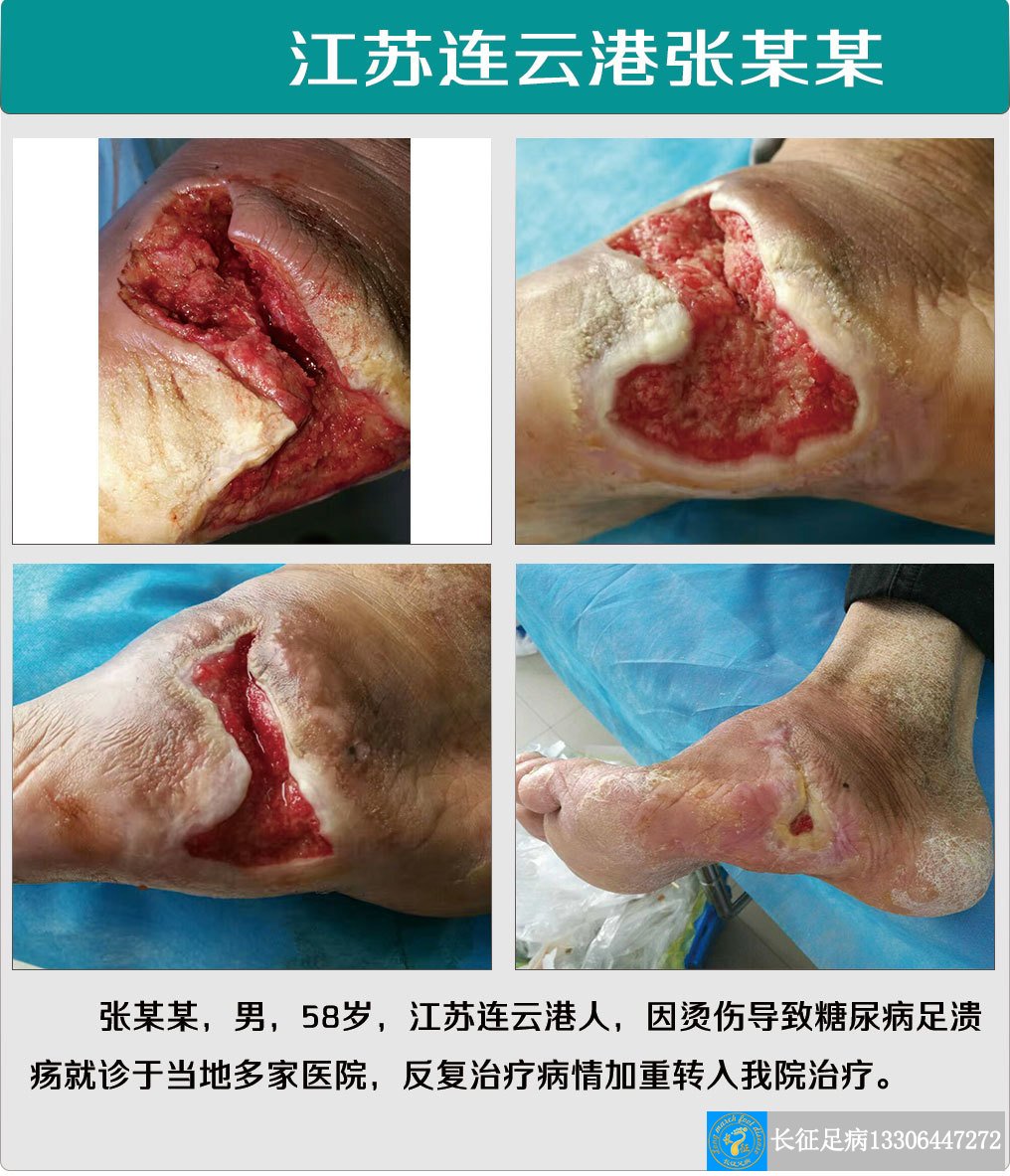 1517388661550644.jpg 1517388661550644.jpg